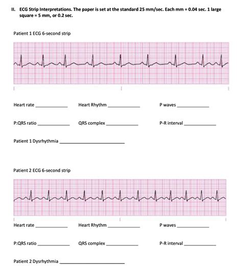 04 seconds and each large box is 0. . Practice ekg strips game